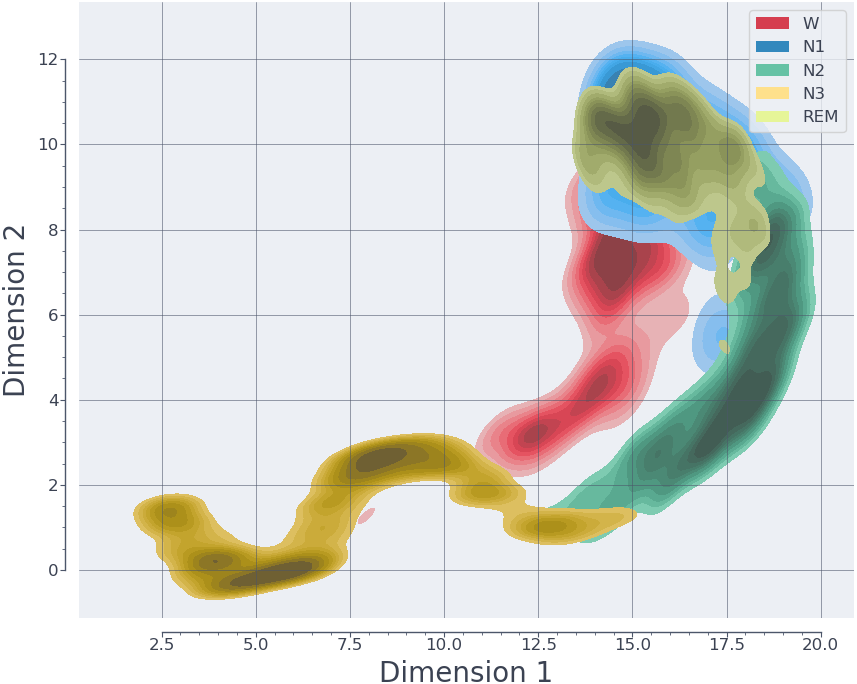 UMAP for Dimensionality Reduction in Sleep Stage Classification Using EEG Data